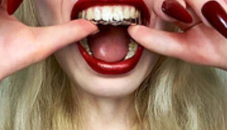 Orthodontic Cap & Spitting