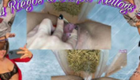 ?4 IRRIGATIONS TO CRISPIS KELLOGS 2