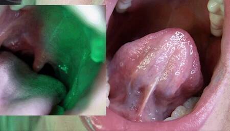 Stomach Growl PREDATOR (Mobile)