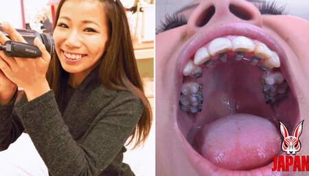 Orthodontic Teeth Fetish : Izumi Asato's Dental Fantasy