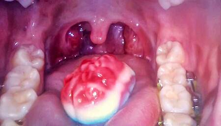 Your Brain VORE - Endoscope