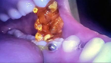 Gummy Bear Swallowing