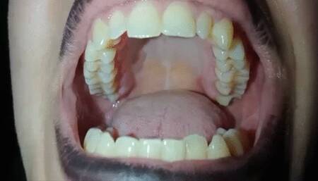 Roof of my big mouth