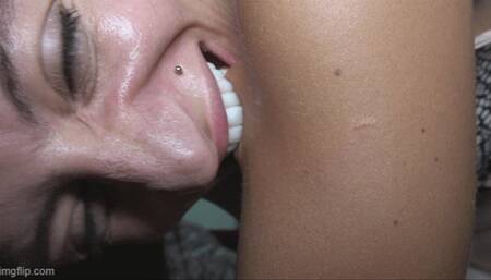 Marks on skin-Special request