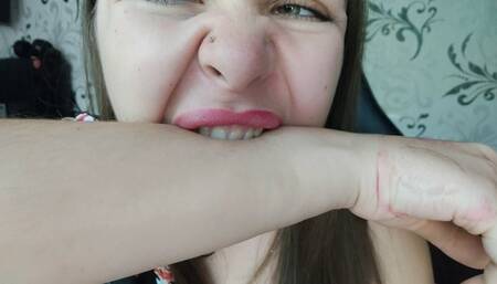 Angelica's hard bites