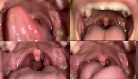 Nathalias Uvula Cam