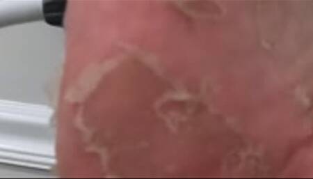 Foot peeling, want a taste