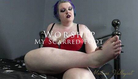 Worship My Scarred Foot