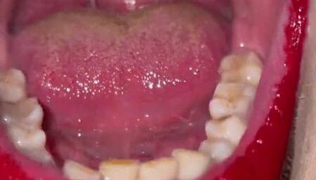 Mouthtour through a chain- smoking mouth