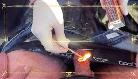 Ein Brennen im Schritt - GERMAN