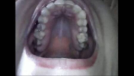 Endoscopic yawning