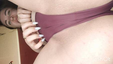 Angelica's body scabies!