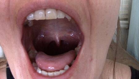 Sarah's Uvula Dangle