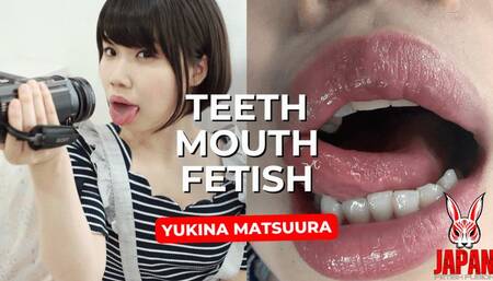Mouth Fantasy: Dental Selfies with Sensual Yukina MATSUURA