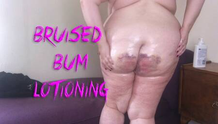 Bruised Bum Lotioning - wmv