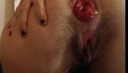 INSANE ANAL i fuck my biggest toys - prolapsing