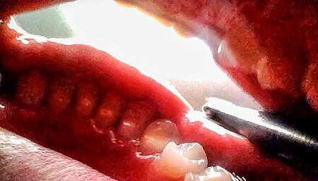 Yawning - Reverse View CUSTOM