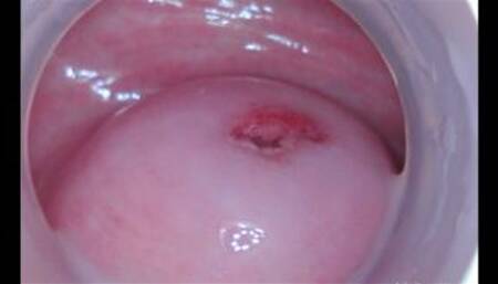 Beautiful Cervix and Inside Pussy - BTS No Audio