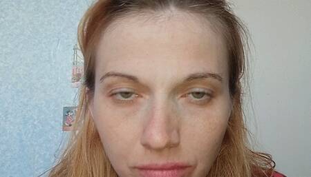 Trying to squeeze the eye out of the eye socket