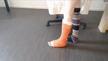 I Am Showing You My Leg In A Cast From All Sides