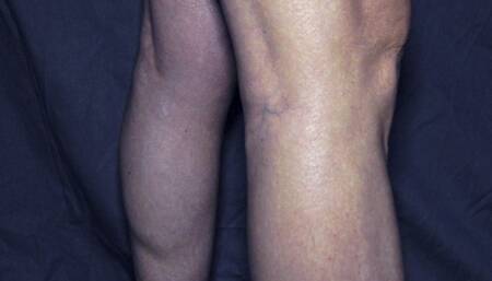 Dance The Muscles 93