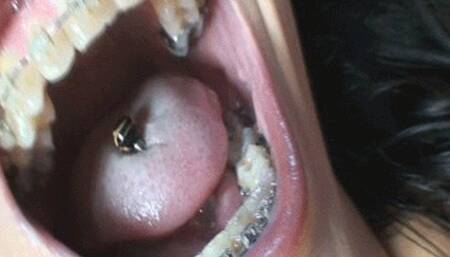 Wenona "Tongue & Braces"