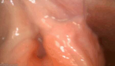 look inside my bladder