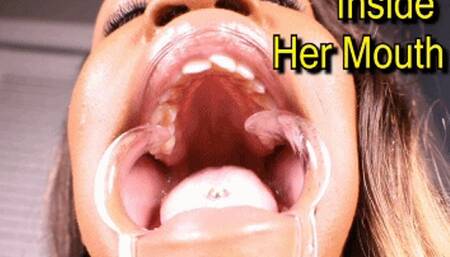 Inside Harmonie's Mouth (iPhone)