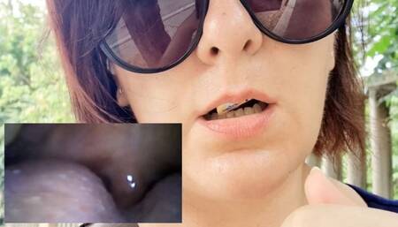 MiroCam new Vore exploration with medical PillCam in outdoor 4K