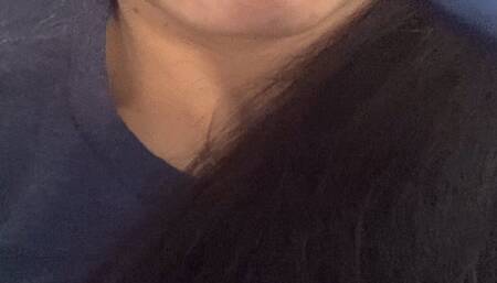 Cracked lips and teeth