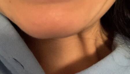 Disgusting crooked teeth