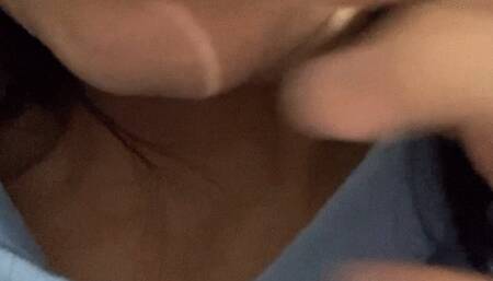 Crooked teeth and dirty gums