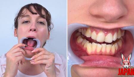 Dental Examination with Clara Luroa