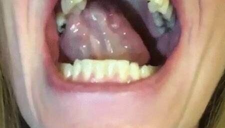 MOUTH WIDE OPEN