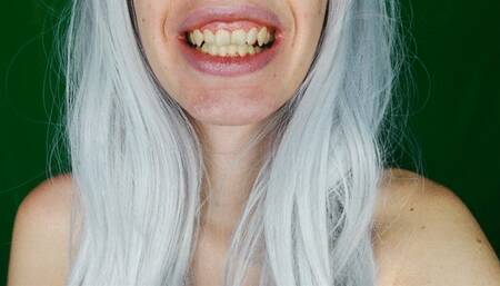 My teeth are chattering (NO AUDIO)