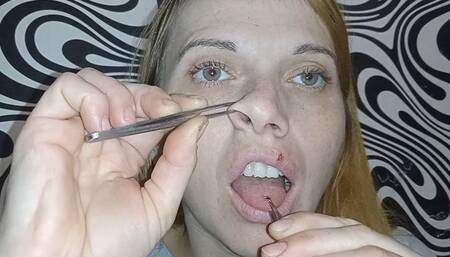 A medical tour of my face