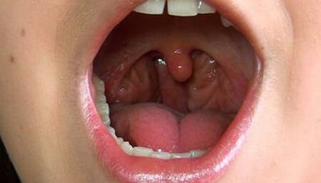 Face And Open Mouth HD-720