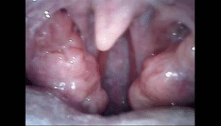 After blowjob, endoscopy