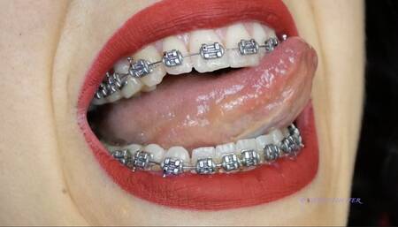 Braces and red lipstick