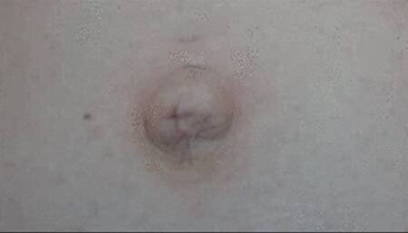 CONVEX NAVEL EXTREME CLOSEUP (E)