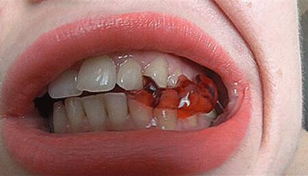 My teeth with sexy fangs!MP4