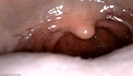 yawning uvula endoscopy (720 mp4)