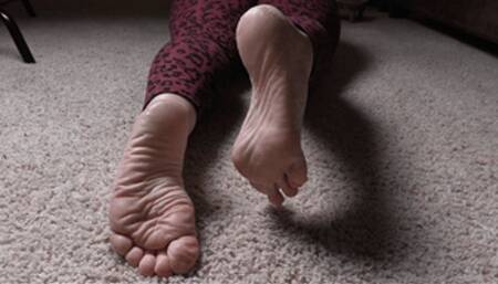 Dry Wrinkled Soles Of Raquelle, 3rd