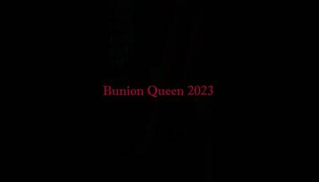 Bunions in transparent sexy shoes