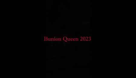 Bunions in red sandals