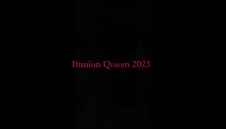 Bunions in sexy high heels