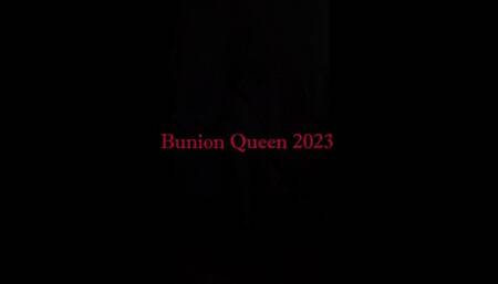 bunions in red shoes and red dress