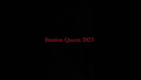 Bunions in sexy shoes