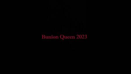 Bunions in sexy sandals