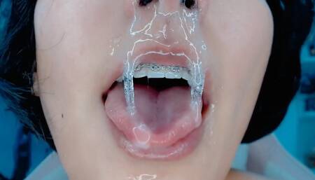 My density snots with out edition